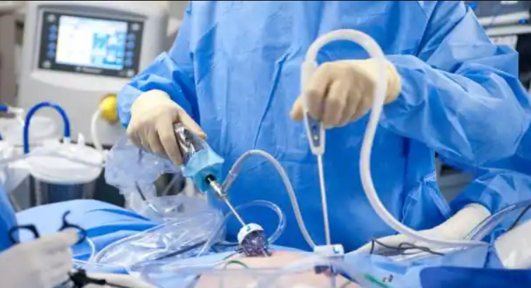 All you Need to know before going for a laparoscopic Surgery