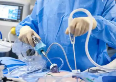 All you Need to know before going for a laparoscopic Surgery
